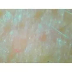 Фото Аппарат (эл-й микроскоп) для исследования кожи и волос RL-2001 + USB + 2 линзы 50х и 200х - 15