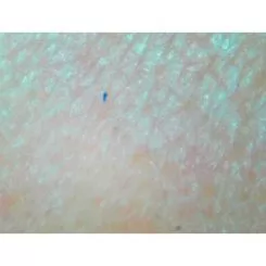 Фото Аппарат (эл-й микроскоп) для исследования кожи и волос RL-2002 + TV + 2 линзы 50х и 200х - 18